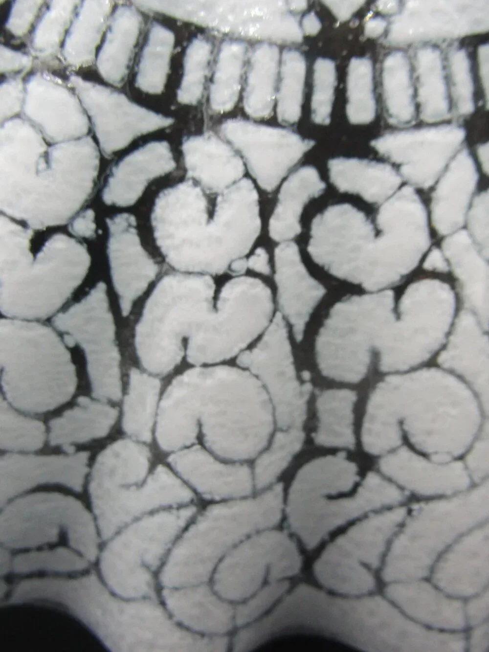 Sydenstricker 12 fused